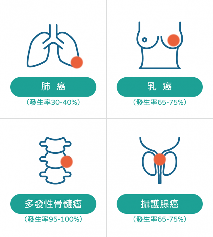 什麼是癌症骨轉移